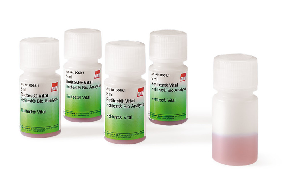 Vitality Assay & Cell Counting