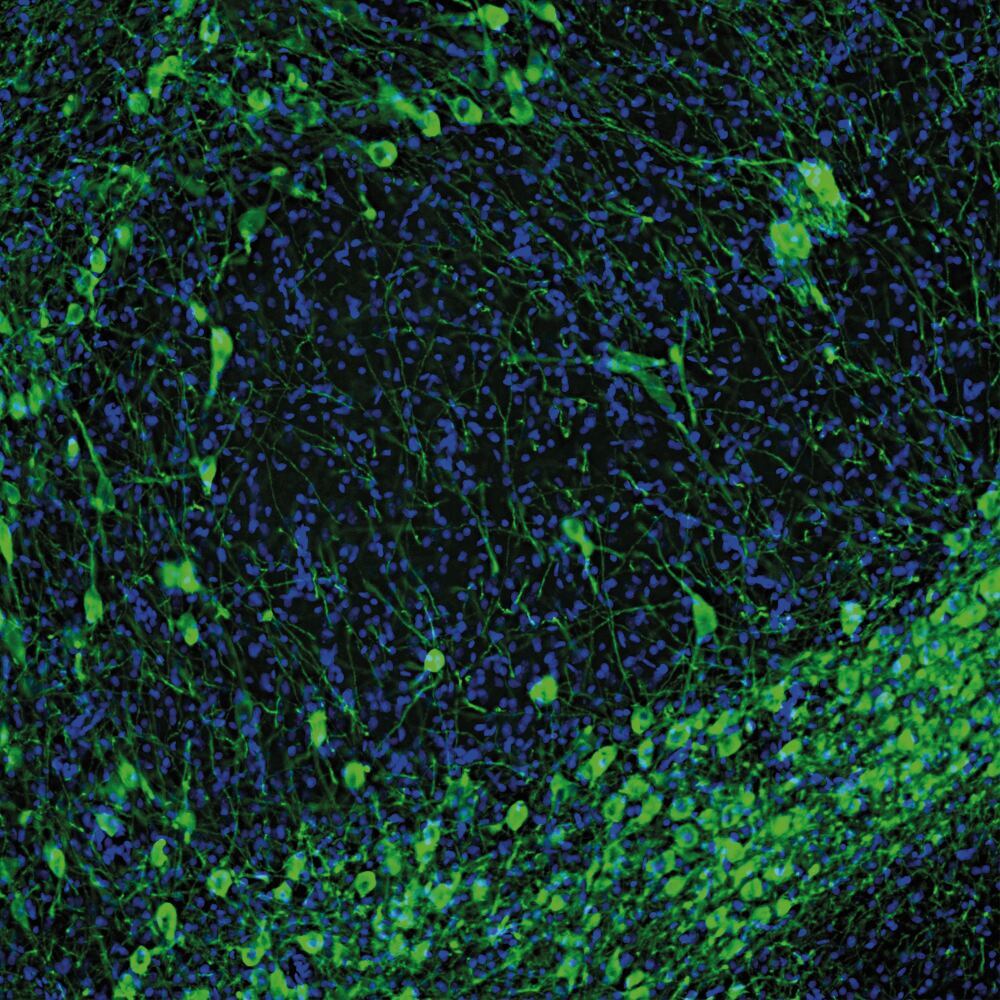 3C1K.1, Antibodies.Com