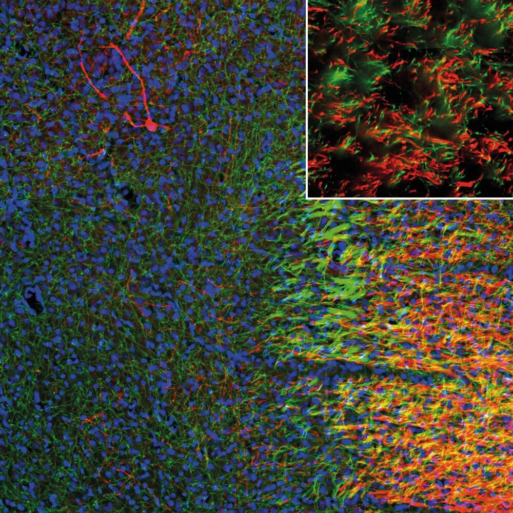 Anti-SERT Antibody, 100 µl