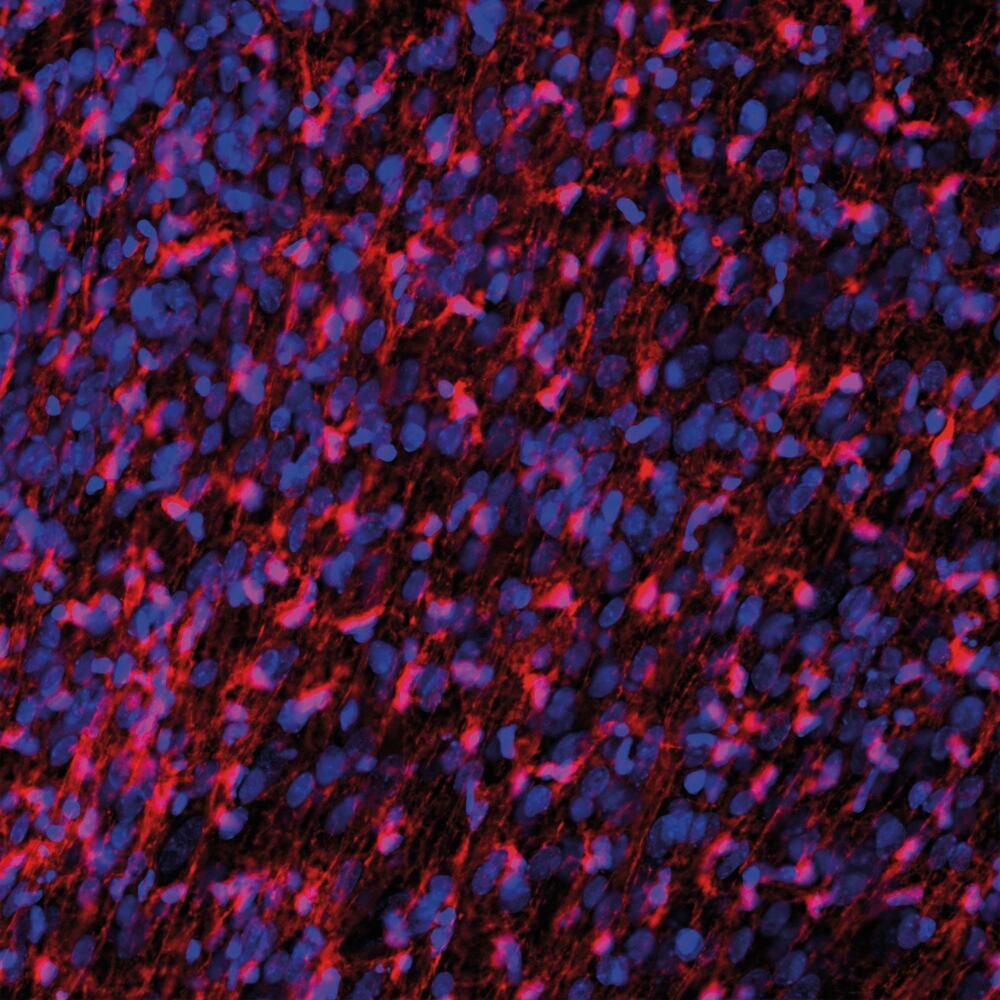 3C1X.2, Antibodies.Com