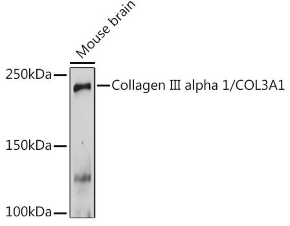 3CHP.1, Antibodies.Com