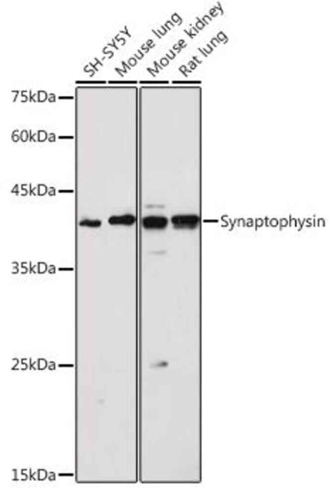 3CLT.1, Antibodies.Com