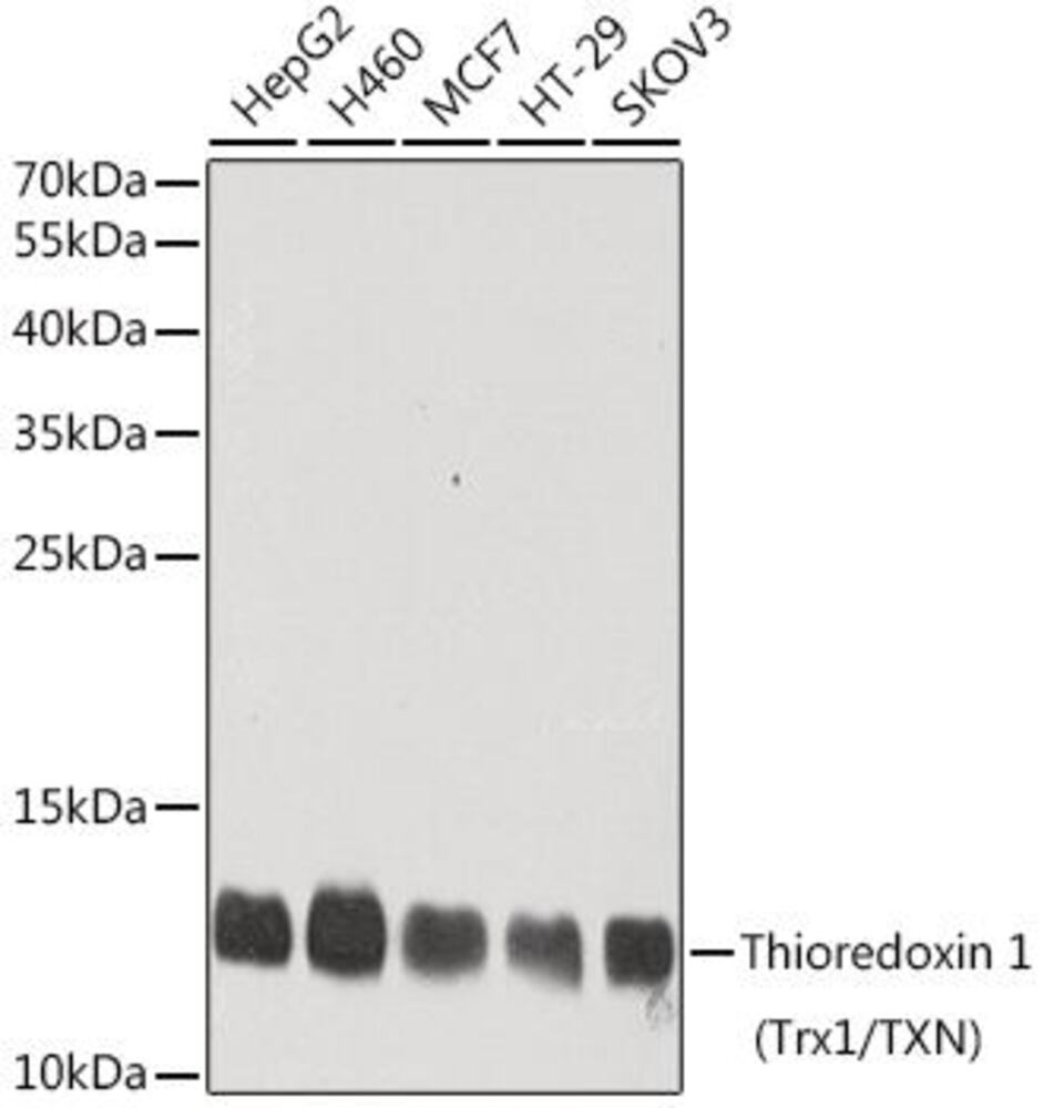 Anti-Thioredoxin / TRX Antibody