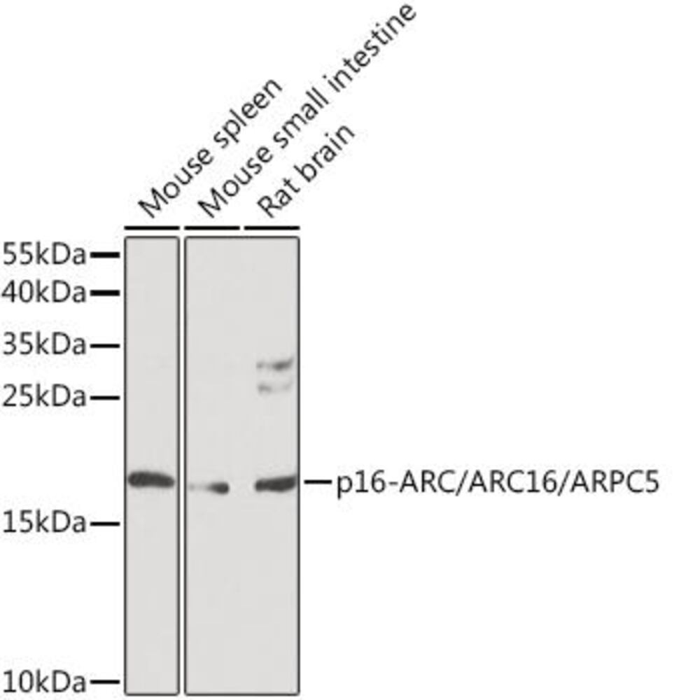3CPN.1, Antibodies.Com