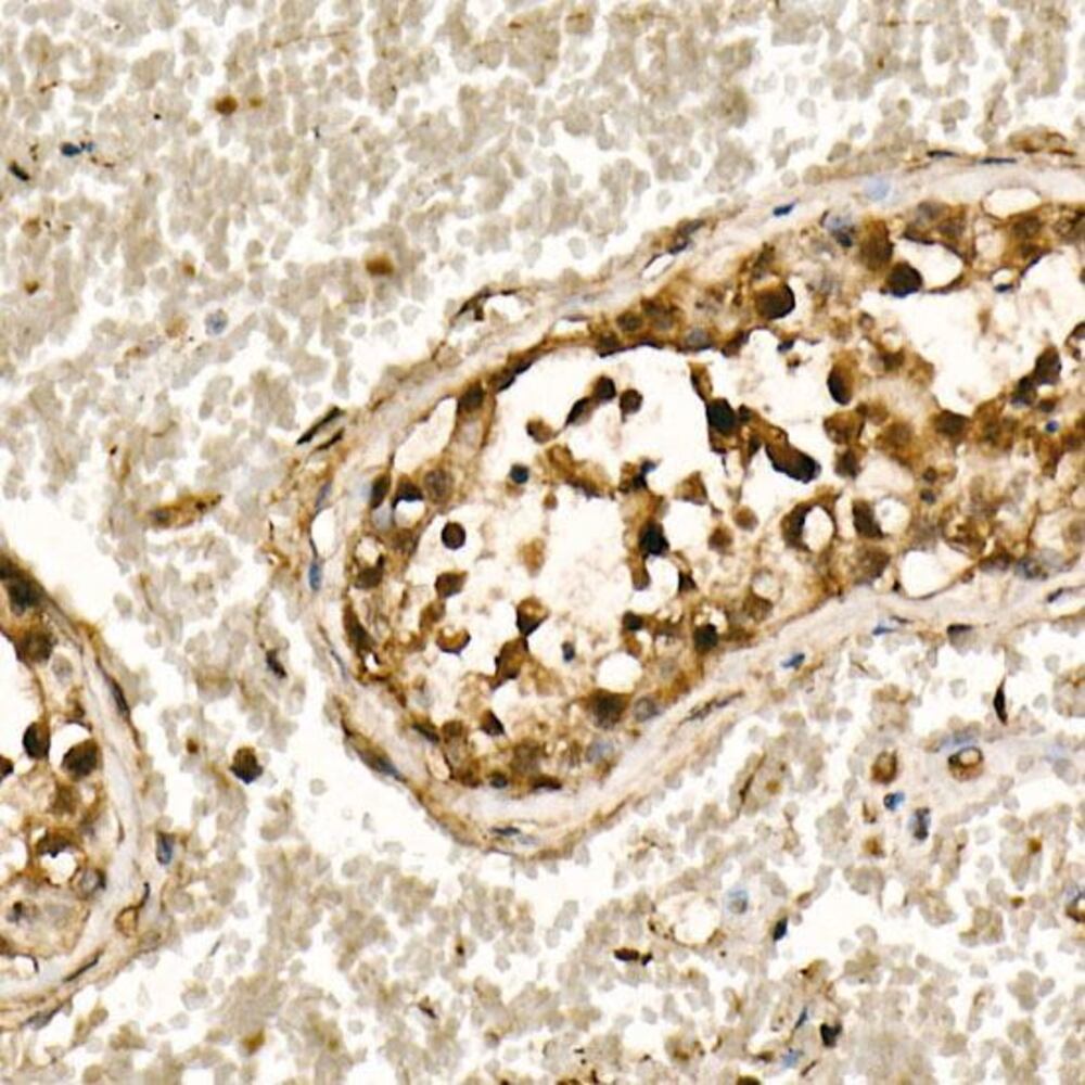 3CXK.1, Antibodies.Com