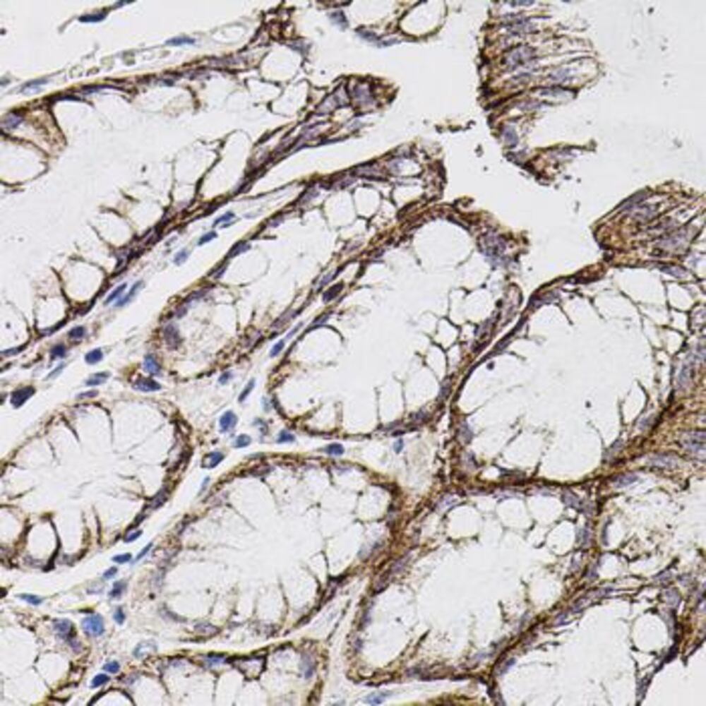 3E0X.1, Antibodies.Com