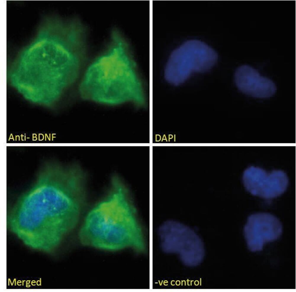 3E2E.1, Antibodies.Com