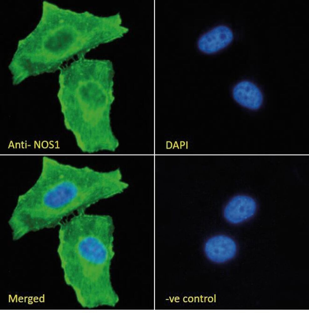 3E2X.1, Antibodies.Com