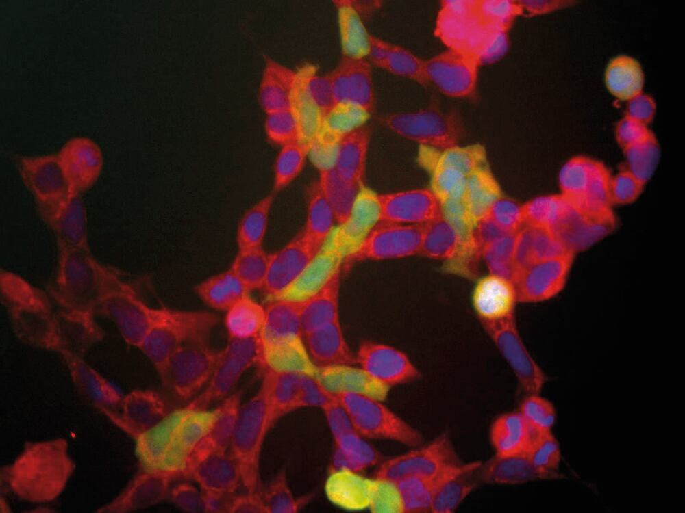 3E43.1, Antibodies.Com