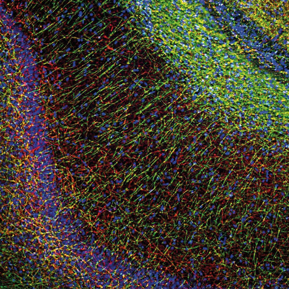 3E49.1, Antibodies.Com