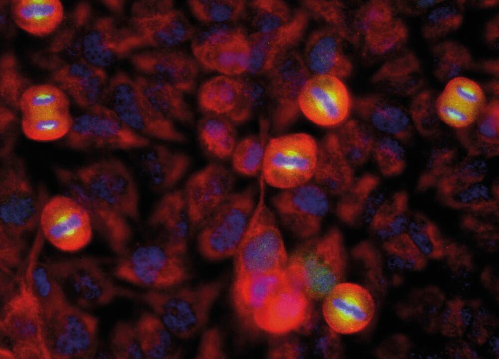 3E55.1, Antibodies.Com