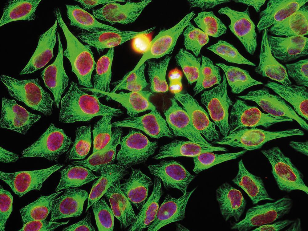 3E5K.2, Antibodies.Com