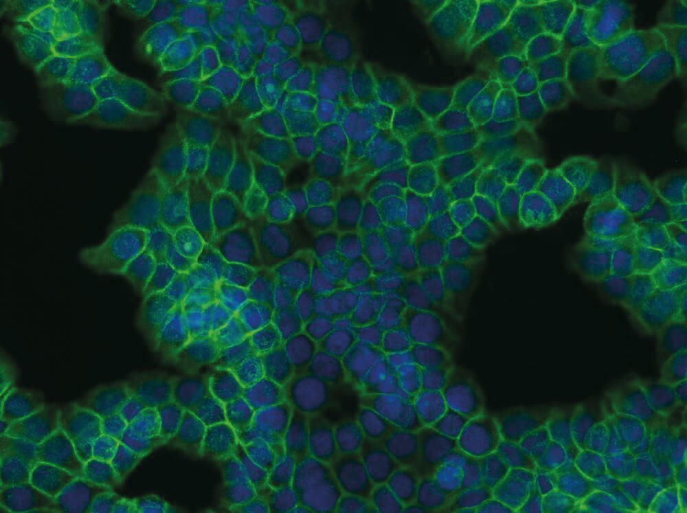 3E81.1, Antibodies.Com