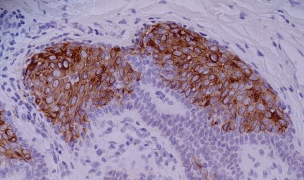 3E87.1, Antibodies.Com
