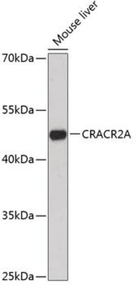 3ECY.1, Antibodies.Com