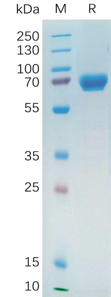 Recombinant Human NRG1 Protein (Fc Tag), 50 µg