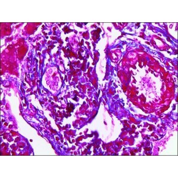 HT151-250ML, Omnilab